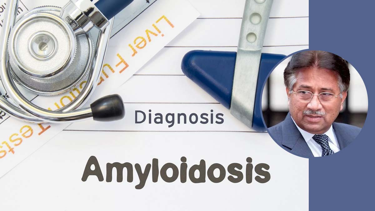 What Is Amyloidosis, The Rare Disease Pervez Musharraf Is Suffering From?